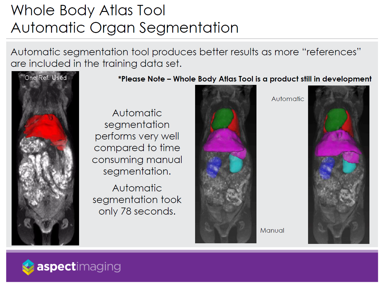 Automatic Organ Segmentation