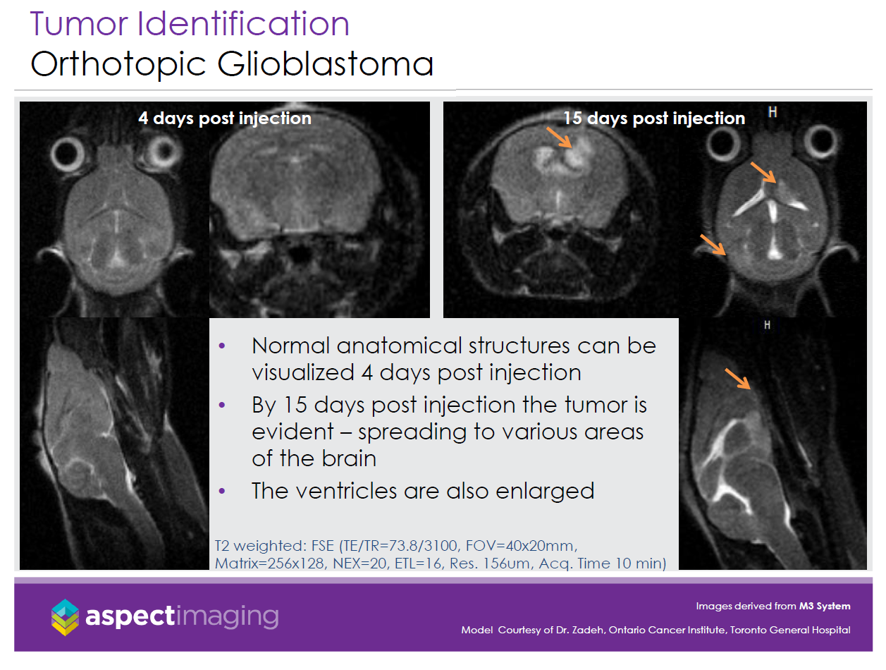 Orthotopic Glioblastoma